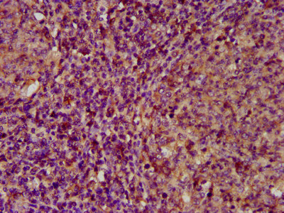 ECM1 Antibody - Immunohistochemistry image at a dilution of 1:200 and staining in paraffin-embedded human tonsil tissue performed on a Leica BondTM system. After dewaxing and hydration, antigen retrieval was mediated by high pressure in a citrate buffer (pH 6.0) . Section was blocked with 10% normal goat serum 30min at RT. Then primary antibody (1% BSA) was incubated at 4 °C overnight. The primary is detected by a biotinylated secondary antibody and visualized using an HRP conjugated SP system.