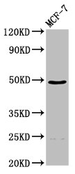 ECM1 Antibody - Positive Western Blot detected in MCF-7 whole cell lysate. All lanes: ECM1 antibody at 4.5 µg/ml Secondary Goat polyclonal to rabbit IgG at 1/50000 dilution. Predicted band size: 61, 47, 20, 64 KDa. Observed band size: 47 KDa