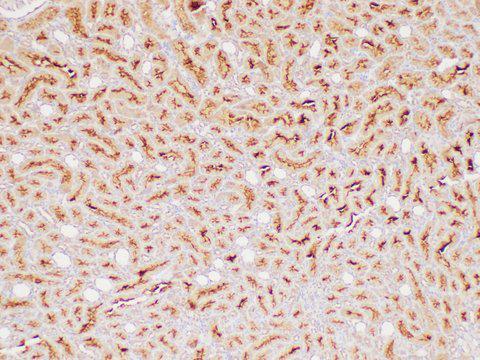 ECM1 Antibody - Immunohistochemistry of paraffin-embedded Rat kidney using ECM1 Polycloanl Antibody at dilution of 1:300