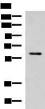 ECM1 Antibody - Western blot analysis of MCF7 cell lysate  using ECM1 Polyclonal Antibody at dilution of 1:1000