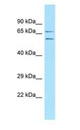 ECM2 Antibody - ECM2 antibody Western Blot of 293T.  This image was taken for the unconjugated form of this product. Other forms have not been tested.