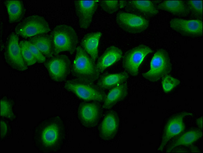 ECSCR Antibody - Immunofluorescence staining of A549 cells with ECSCR Antibody at 1:133, counter-stained with DAPI. The cells were fixed in 4% formaldehyde, permeabilized using 0.2% Triton X-100 and blocked in 10% normal Goat Serum. The cells were then incubated with the antibody overnight at 4°C. The secondary antibody was Alexa Fluor 488-congugated AffiniPure Goat Anti-Rabbit IgG(H+L).