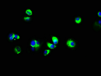 ECSCR Antibody - Immunofluorescence staining of MCF-7 cells with ECSCR Antibody at 1:133, counter-stained with DAPI. The cells were fixed in 4% formaldehyde, permeabilized using 0.2% Triton X-100 and blocked in 10% normal Goat Serum. The cells were then incubated with the antibody overnight at 4°C. The secondary antibody was Alexa Fluor 488-congugated AffiniPure Goat Anti-Rabbit IgG(H+L).