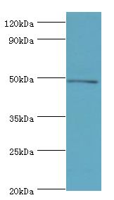 ECSIT Antibody - Western blot. All lanes: Evolutionarily conserved signaling intermediate in Toll pathway, mitochondrial antibody at 10 ug/ml+Jurkat whole cell lysate. secondary Goat polyclonal to rabbit at 1:10000 dilution. Predicted band size: 49 kDa. Observed band size: 49 kDa.