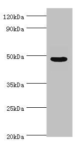 ECSIT Antibody - Western blot All lanes: Evolutionarily conserved signaling intermediate in Toll pathway, mitochondrial antibody at 10µg/ml + Jurkat whole cell lysate Secondary Goat polyclonal to rabbit IgG at 1/10000 dilution Predicted band size: 50, 34, 25 kDa Observed band size: 50 kDa