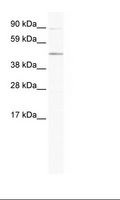 ECSIT Antibody - NIH 3T3 Cell Lysate.  This image was taken for the unconjugated form of this product. Other forms have not been tested.