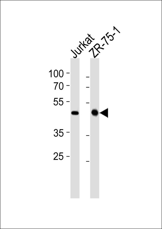ECSIT Antibody - ECSIT Antibody western blot of Jurkat,ZR-75-1 cell line lysates (35 ug/lane). The ECSIT antibody detected the ECSIT protein (arrow).