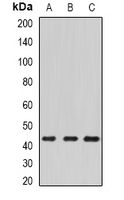 ECSIT Antibody - Western blot analysis of ECSIT expression in HepG2 (A); mouse kidney (B); mouse heart (C) whole cell lysates.