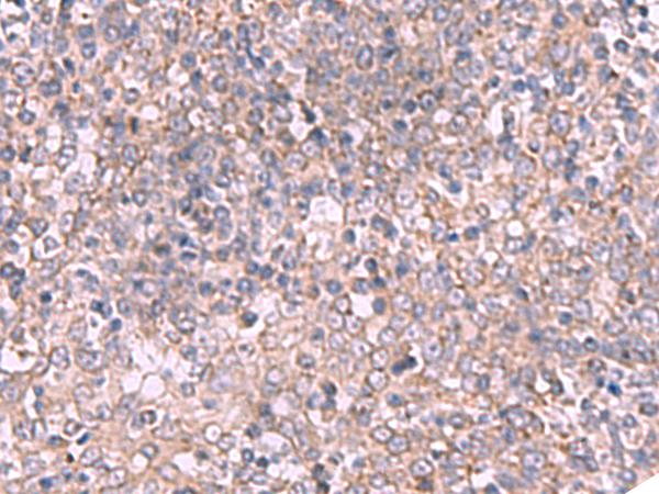 ECSIT Antibody - Immunohistochemistry of paraffin-embedded Human tonsil tissue  using ECSIT Polyclonal Antibody at dilution of 1:70(×200)