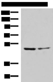 ECSIT Antibody - Western blot analysis of Jurkat and HepG2 cell lysates  using ECSIT Polyclonal Antibody at dilution of 1:1000
