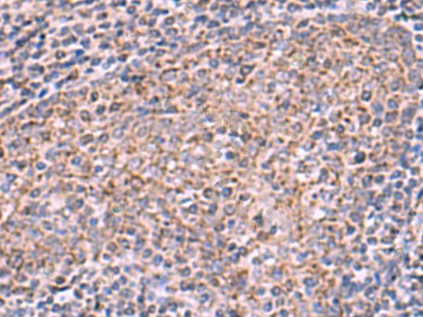 ECSIT Antibody - Immunohistochemistry of paraffin-embedded Human tonsil tissue  using ECSIT Polyclonal Antibody at dilution of 1:75(×200)