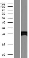 ECSIT Protein - Western validation with an anti-DDK antibody * L: Control HEK293 lysate R: Over-expression lysate
