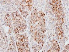 ECT2 Antibody - Anti-ECT2 antibody [N1], N-term used in IHC (Formalin-fixed paraffin-embedded sections).