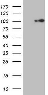 ECT2 Antibody - HEK293T cells were transfected with the pCMV6-ENTRY control (Left lane) or pCMV6-ENTRY ECT2 (Right lane) cDNA for 48 hrs and lysed. Equivalent amounts of cell lysates (5 ug per lane) were separated by SDS-PAGE and immunoblotted with anti-ECT2.