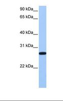 ECT2 Antibody - Hela cell lysate. Antibody concentration: 1.0 ug/ml. Gel concentration: 12%.  This image was taken for the unconjugated form of this product. Other forms have not been tested.