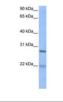 ECT2 Antibody - HepG2 cell lysate. Antibody concentration: 1.0 ug/ml. Gel concentration: 12%.  This image was taken for the unconjugated form of this product. Other forms have not been tested.