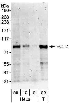 ECT2 Antibody - Detection of Human ECT2 by Western Blot. Samples: Whole cell lysate (5, 15 and 50 ug) from HeLa and 293T (T; 50 ug) cells. Antibody: Affinity purified rabbit anti-ECT2 antibody used for WB at 0.1 ug/ml. Detection: Chemiluminescence with an exposure time of 3 minutes.