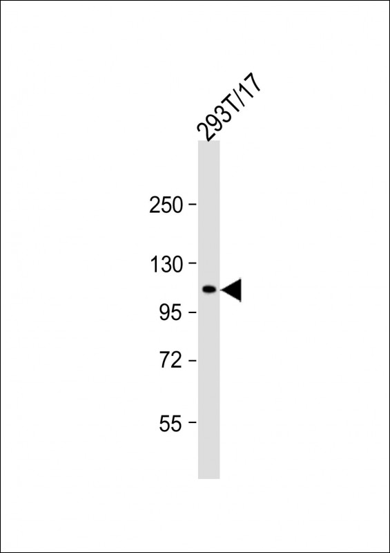 ECT2 Antibody - Anti-ECT2 Antibody at 1:1000 dilution + 293T/17 whole cell lysate Lysates/proteins at 20 µg per lane. Secondary Goat Anti-mouse IgG, (H+L), Peroxidase conjugated at 1/10000 dilution. Predicted band size: 104 kDa Blocking/Dilution buffer: 5% NFDM/TBST.