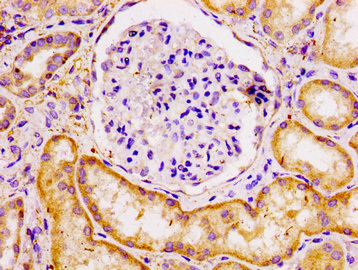 ECT2 Antibody - Immunohistochemistry image at a dilution of 1:100 and staining in paraffin-embedded human kidney tissue performed on a Leica BondTM system. After dewaxing and hydration, antigen retrieval was mediated by high pressure in a citrate buffer (pH 6.0) . Section was blocked with 10% normal goat serum 30min at RT. Then primary antibody (1% BSA) was incubated at 4 °C overnight. The primary is detected by a biotinylated secondary antibody and visualized using an HRP conjugated SP system.
