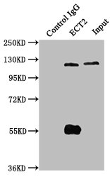 ECT2 Antibody - Immunoprecipitating ECT2 in Hela whole cell lysate Lane 1: Rabbit control IgG instead of ECT2 Antibody in Hela whole cell lysate.For western blotting, a HRP-conjugated Protein G antibody was used as the secondary antibody (1/50000) Lane 2: ECT2 Antibody (6µg) + Hela whole cell lysate (1mg) Lane 3: Hela whole cell lysate (20µg)