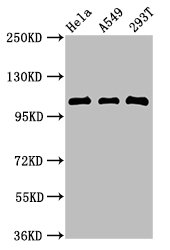 ECT2 Antibody - Western Blot Positive WB detected in: Hela whole cell lysate, A549 whole cell lysate, 293T whole cell lysate All lanes:ECT2 antibody at 2.7µg/ml Secondary Goat polyclonal to rabbit IgG at 1/50000 dilution Predicted band size: 104, 100, 109, 101 kDa Observed band size: 104 kDa