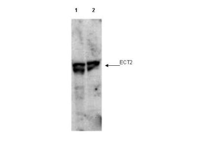 ECT2 Antibody - Anti-ECT2 pT790 Antibody - Western Blot. Western blot of affinity purified anti-ECT2 pT790 antibody shows detection of endogenous phosphorylated ECT2 (arrowhead) present in cell lysates from interphase (lane 1) and mitotic (lane 2) HeLa cells. Despite specific staining of interphase cells, this reagent is believed to be phospho specific based on ELISA results using both phosphorylated and non-phosphorylated immunizing peptide. After SDS-PAGE and transfer, the membrane was probed with the primary antibody diluted to 1:1000. Personal Communication, Toru Miki, CCR-NCI, Bethesda, MD.