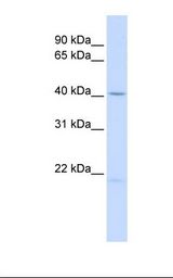 EDA / Ectodysplasin A Antibody - 721_B cell lysate. Antibody concentration: 1.0 ug/ml. Gel concentration: 12%.  This image was taken for the unconjugated form of this product. Other forms have not been tested.