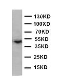 EDA / Ectodysplasin A Antibody - WB of EDA / ED1 antibody. WB: SW620 Cell Lysate.