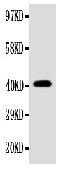 EDA / Ectodysplasin A Antibody - Anti-EDA antibody, Western blottingWB: SW620 Cell Lysate