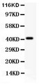 EDA / Ectodysplasin A Antibody - EDA antibody Western blot. All lanes: Anti EDA at 0.5 ug/ml. WB: COLO320 Whole Cell Lysate at 40 ug. Predicted band size: 41 kD. Observed band size: 41 kD.