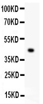 EDA / Ectodysplasin A Antibody - EDA antibody Western blot. All lanes: Anti EDA at 0.5 ug/ml. WB : Recombinant Human EDA Protein 0.5ng. Predicted band size: 43 kD. Observed band size: 43 kD.