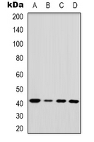 EDA / Ectodysplasin A Antibody - Western blot analysis of EDA expression in HeLa (A); mouse lung (B); mouse heart (C); mouse liver (D) whole cell lysates.
