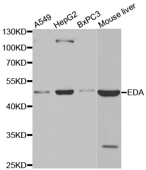 EDA / Ectodysplasin A Antibody - Western blot analysis of extracts of various cell lines.