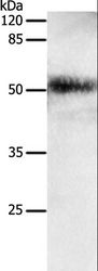 EDA / Ectodysplasin A Antibody - Western blot analysis of Human lung cancer tissue, using EDA Polyclonal Antibody at dilution of 1:650.