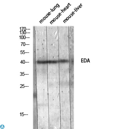 EDA / Ectodysplasin A Antibody - Western Blot (WB) analysis of Mouse Lung Mouse Heart Mouse Liver lysis using EDA antibody.