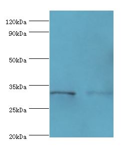 EDA2R / XEDAR Antibody - Western blot. All lanes: Tumor necrosis factor receptor superfamily member 27 antibody at 6 ug/ml. Lane 1: HepG2 whole cell lysate. Lane 2: HeLa whole cell lysate. secondary Goat polyclonal to rabbit at 1:10000 dilution. Predicted band size: 33 kDa. Observed band size: 33 kDa.