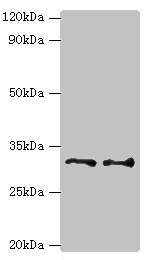 EDA2R / XEDAR Antibody - Western blot All lanes: Tumor necrosis factor receptor superfamily member 27 antibody at 6µg/ml Lane 1: HepG2 whole cell lysate Lane 2: Hela whole cell lysate Secondary Goat polyclonal to rabbit IgG at 1/10000 dilution Predicted band size: 33, 36 kDa Observed band size: 33 kDa