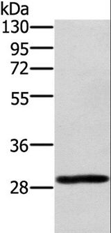 EDA2R / XEDAR Antibody - Western blot analysis of 293T cell, using EDA2R Polyclonal Antibody at dilution of 1:450.