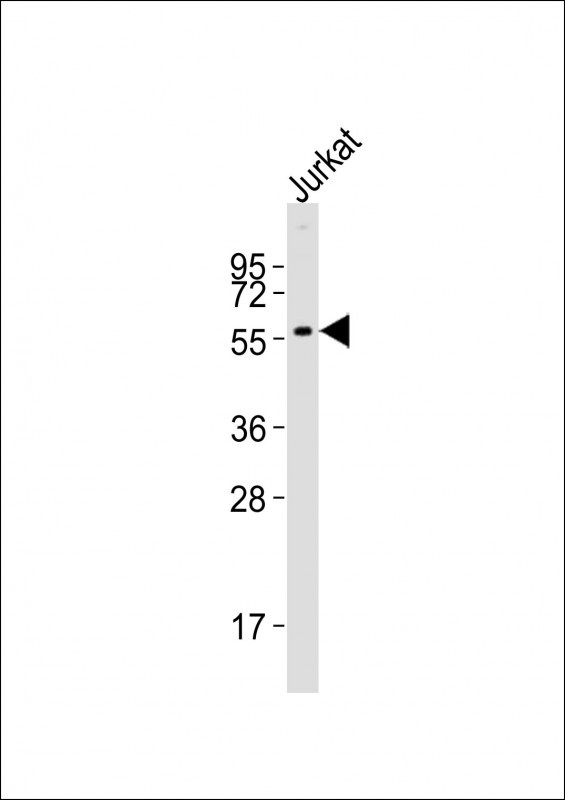 EDAG / HEMGN Antibody - Anti-HEMGN Antibody at 1:2000 dilution + Jurkat whole cell lysates Lysates/proteins at 20 ug per lane. Secondary Goat Anti-Rabbit IgG, (H+L), Peroxidase conjugated at 1/10000 dilution Predicted band size : 55 kDa Blocking/Dilution buffer: 5% NFDM/TBST.