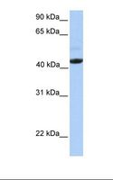 EDAR Antibody - Placenta lysate. Antibody concentration: 1.0 ug/ml. Gel concentration: 12%.  This image was taken for the unconjugated form of this product. Other forms have not been tested.
