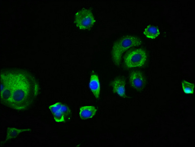 EDAR Antibody - Immunofluorescence staining of MCF-7 cells with EDAR Antibody at 1:166, counter-stained with DAPI. The cells were fixed in 4% formaldehyde, permeabilized using 0.2% Triton X-100 and blocked in 10% normal Goat Serum. The cells were then incubated with the antibody overnight at 4°C. The secondary antibody was Alexa Fluor 488-congugated AffiniPure Goat Anti-Rabbit IgG(H+L).