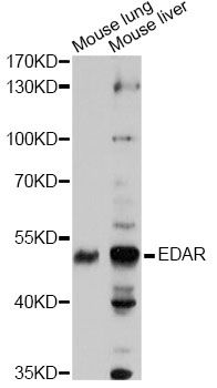 EDAR Antibody - Western blot analysis of extracts of various cell lines, using EDAR antibody at 1:1000 dilution. The secondary antibody used was an HRP Goat Anti-Rabbit IgG (H+L) at 1:10000 dilution. Lysates were loaded 25ug per lane and 3% nonfat dry milk in TBST was used for blocking. An ECL Kit was used for detection and the exposure time was 90s.