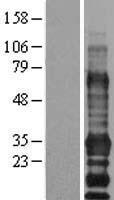 EDARADD Protein - Western validation with an anti-DDK antibody * L: Control HEK293 lysate R: Over-expression lysate