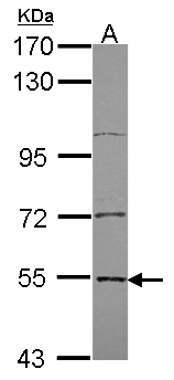 EDC3 Antibody - Sample (30 ug of whole cell lysate). A: A431 . 7.5% SDS PAGE. EDC3 antibody diluted at 1:3000.