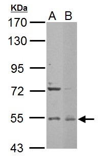 EDC3 Antibody - Edc3 antibody [N2C2], Internal detects EDC3 protein by Western blot analysis. A. 30 ug NIH-3T3 whole cell lysate/extract. B. 30 ug C2C12 whole cell lysate/extract. 7.5 % SDS-PAGE. Edc3 antibody [N2C2], Internal dilution:1:1000