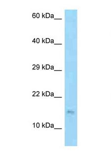 EDDM3B Antibody - EDDM3B antibody Western blot of Jurkat Cell lysate. Antibody concentration 1 ug/ml.  This image was taken for the unconjugated form of this product. Other forms have not been tested.
