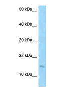 EDDM3B Antibody - EDDM3B antibody Western blot of Jurkat Cell lysate. Antibody concentration 1 ug/ml.  This image was taken for the unconjugated form of this product. Other forms have not been tested.