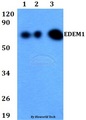 EDEM1 / EDEM Antibody - Western blot of EDEM1 antibody at 1:500 dilution. Lane 1: HEK293T whole cell lysate. Lane 2: Raw264.7 whole cell lysate. Lane 3: PC12 whole cell lysate.