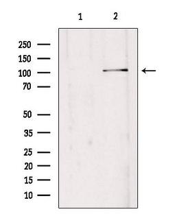 EDEM3 Antibody - Western blot analysis of extracts of HepG2 cells using EDEM3 antibody. Lane 1 was treated with the blocking peptide.