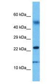 EDF1 / MBF1 Antibody - EDF1 / MBF1 antibody Western Blot of Uterus Tumor. Antibody dilution: 1 ug/ml.  This image was taken for the unconjugated form of this product. Other forms have not been tested.